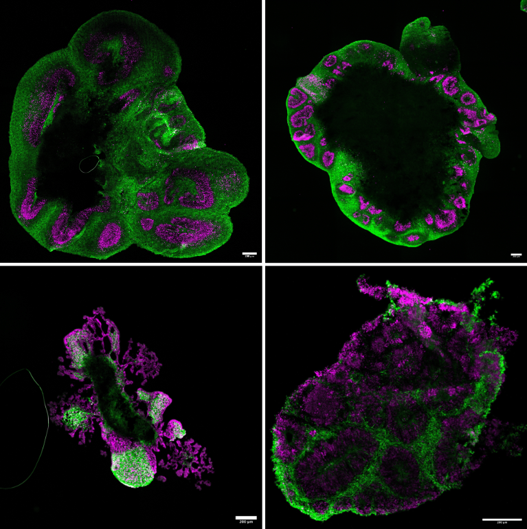 Cortical organoids derived from control and CLN3 mutated lines